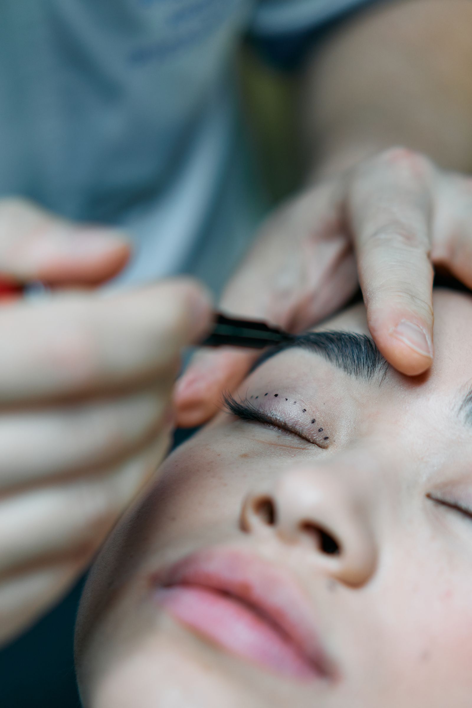 Facelift surgery preparation at Dermax Medical Center Dubai