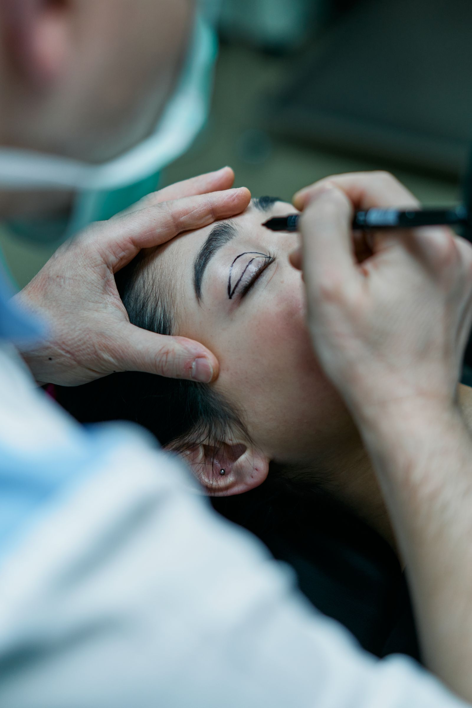 Facial plastic surgery eyelid marking by surgeon