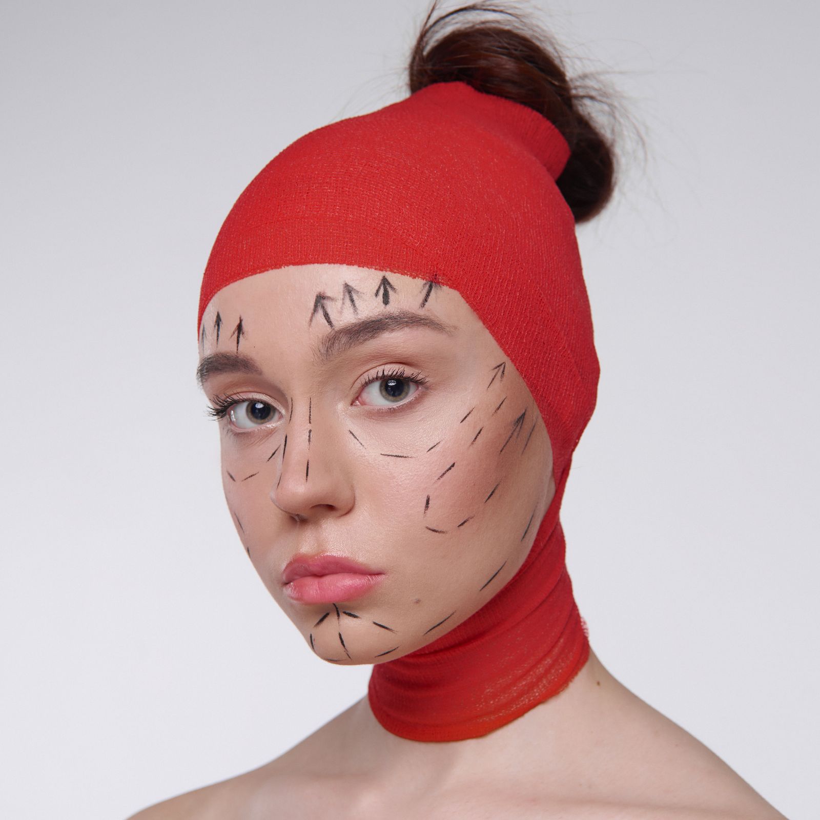 Liposuction surgical markings before body sculpting Dubai