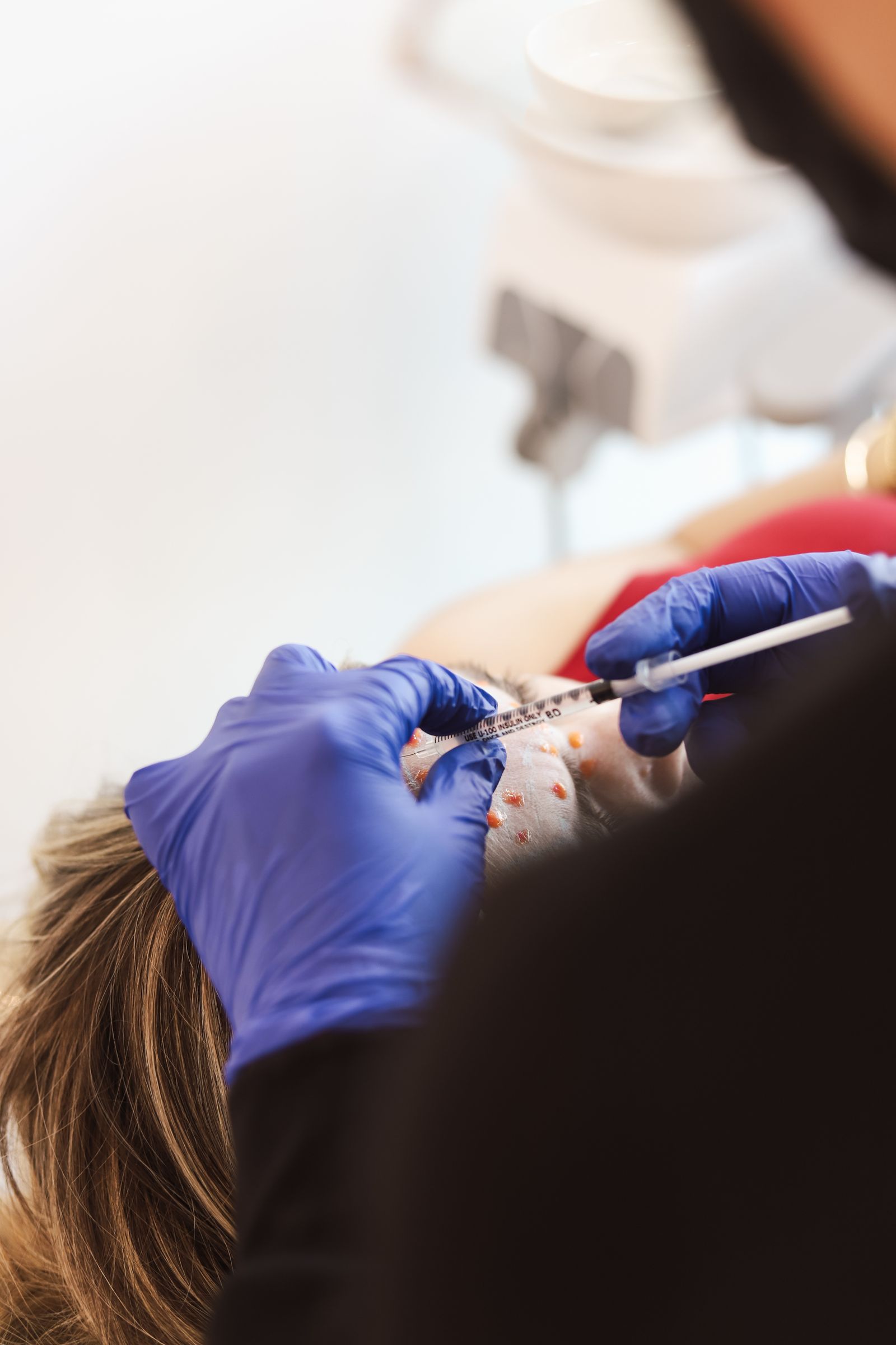 Minimally invasive facial injection procedure Dubai