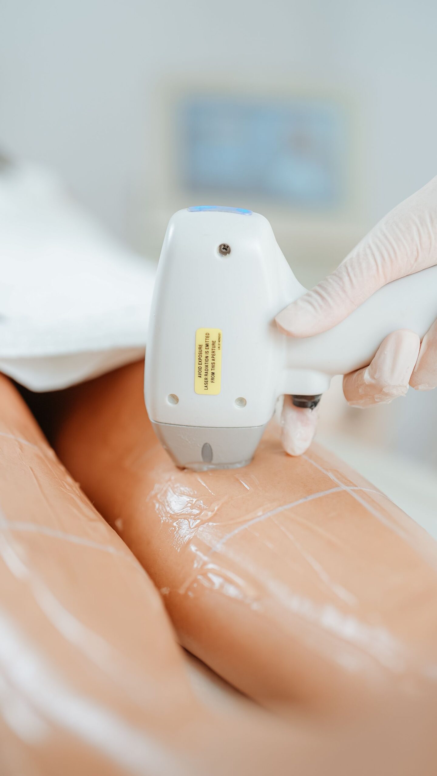 Non-surgical body contouring treatment in aesthetic clinic